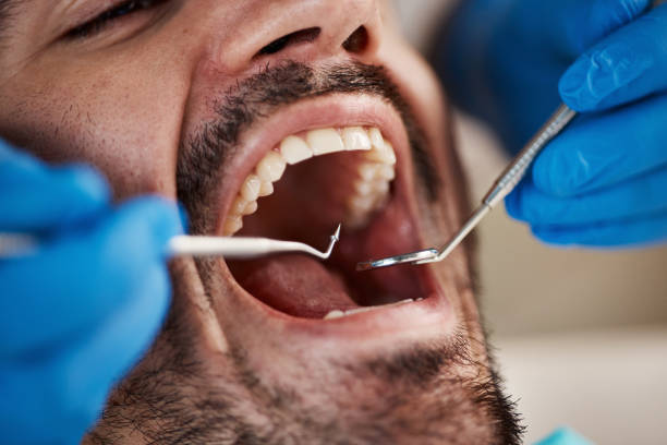 Best Weekend Emergency Dentist in Berry Creek, CA